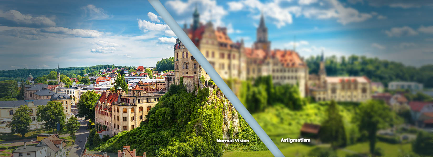 Astigmatism Treatment in Beachwood